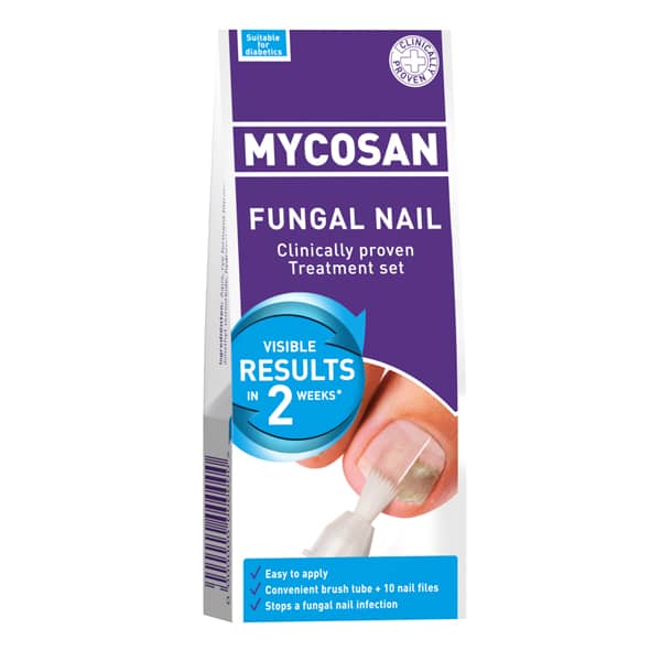 Nail Fungus: Symptoms, Causes & Treatment
