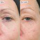 bio-active_ceramide_moisturizer_1